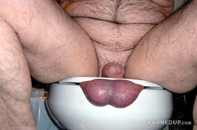 smushed balls in a toilet seat