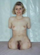 Naked woman with no arms and legs