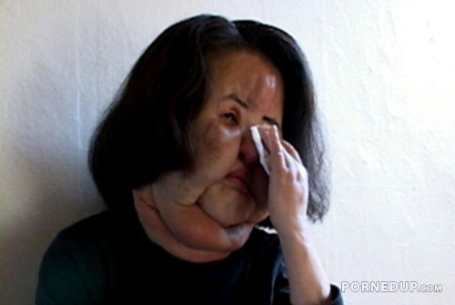 chinese woman with huge droopy face