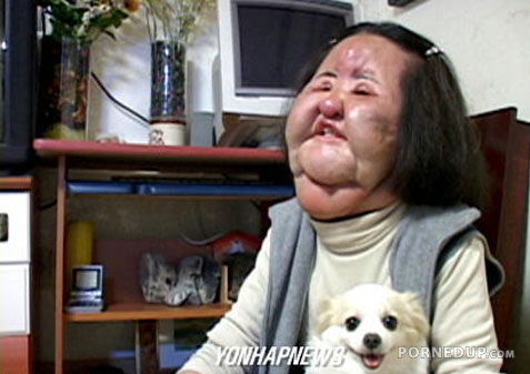 chinese woman with huge droopy face