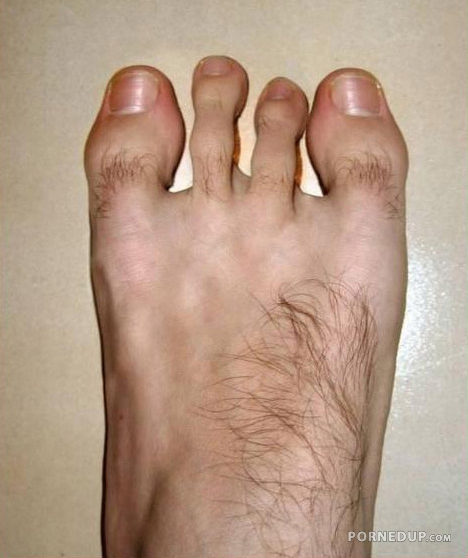 fucked up foot with 4 toes and two big toes