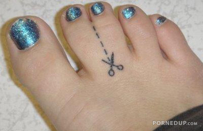 girl with two toes fused together