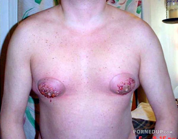 guy has fucked up nipples