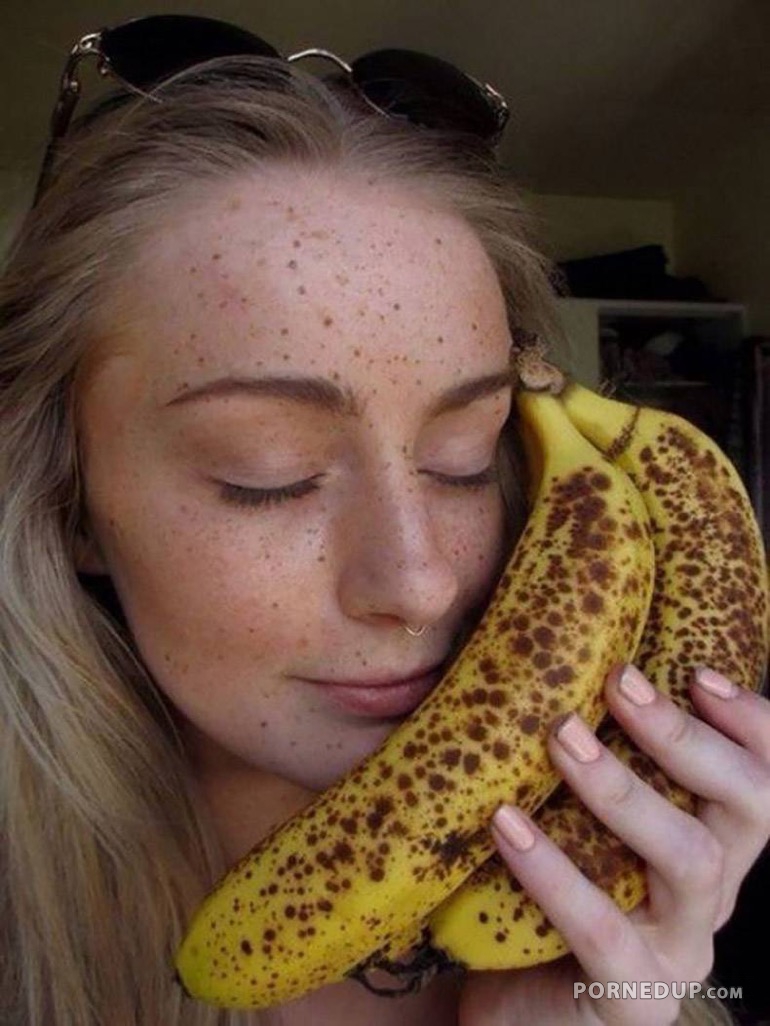 Hot Girl Got Freckles Like A Rotten Banana