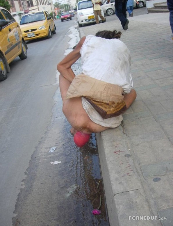 old woman with prolapsed rectum in street