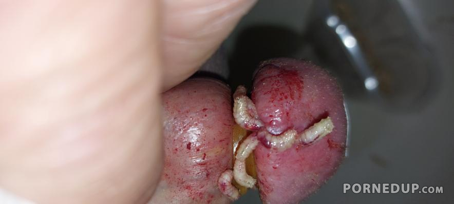 Pain cbt insertion bdsm maggots pervers