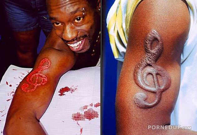 scarification