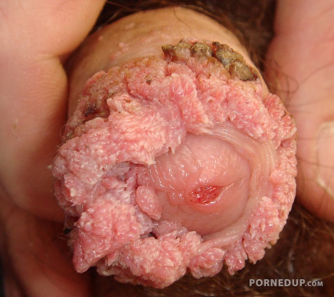 The most disgusting penis ever - Porned Up!