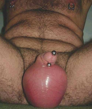 ballsack filled with saline ballsack filled with saline