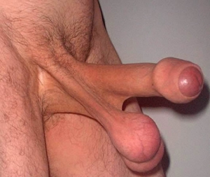 fucked up weird dick fucked up weird dick