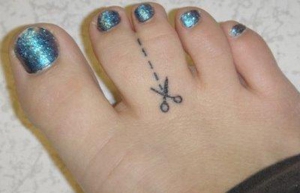 girl with two toes fused together