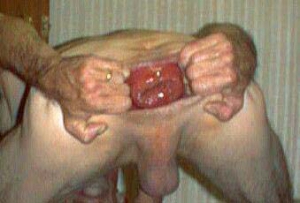 goatse man spreading his ass open