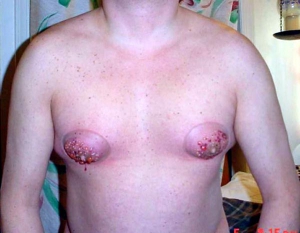 guy has fucked up nipples