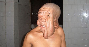 guy with melting face guy with melting face