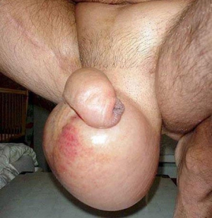 huge filled ballsack huge filled ballsack