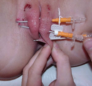 needles through her pussy lips needles through her pussy lips