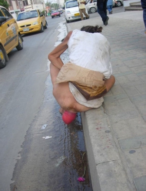 old woman with prolapsed rectum in street