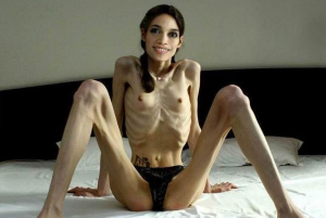 Pro Anorexia Pic
