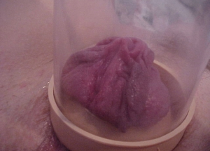 weird pumped up rosebud