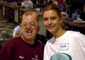 weird ugly guy with messed up teeth