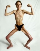 Anorexic topless girl