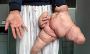 Guy with one fucked up huge hand