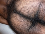 Hairy Ass