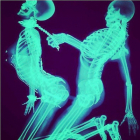 Hardcore Fucking On X-ray