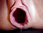 Huge gaped pussy