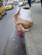 Old woman with prolapsed rectum in street