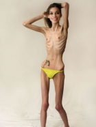 Topless anorexic shows off for camera