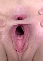 Two gaping holes
