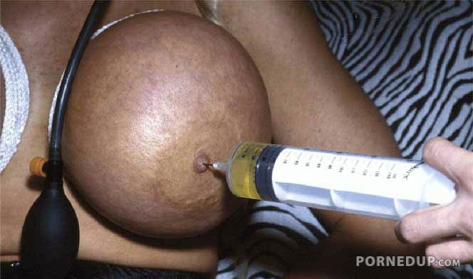 titty injection